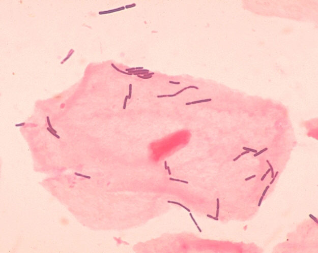File:Lactobacillus micrograph.png