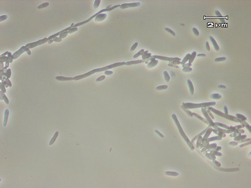 File:Brettanomyces micrograph.jpg